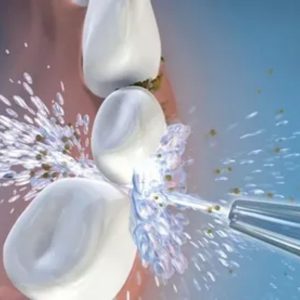 Does a Water Flosser Do the Job?