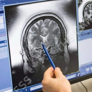 Umm... Is Your Brain Breaking?