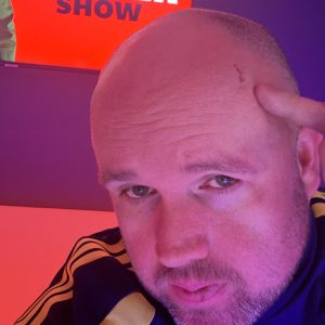 playlist-item-How Did You Get That Scar?