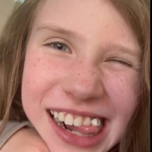 DIY Dentist