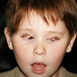 Kids Who Flip Their Eyelids Are More Likely to Commit Crimes